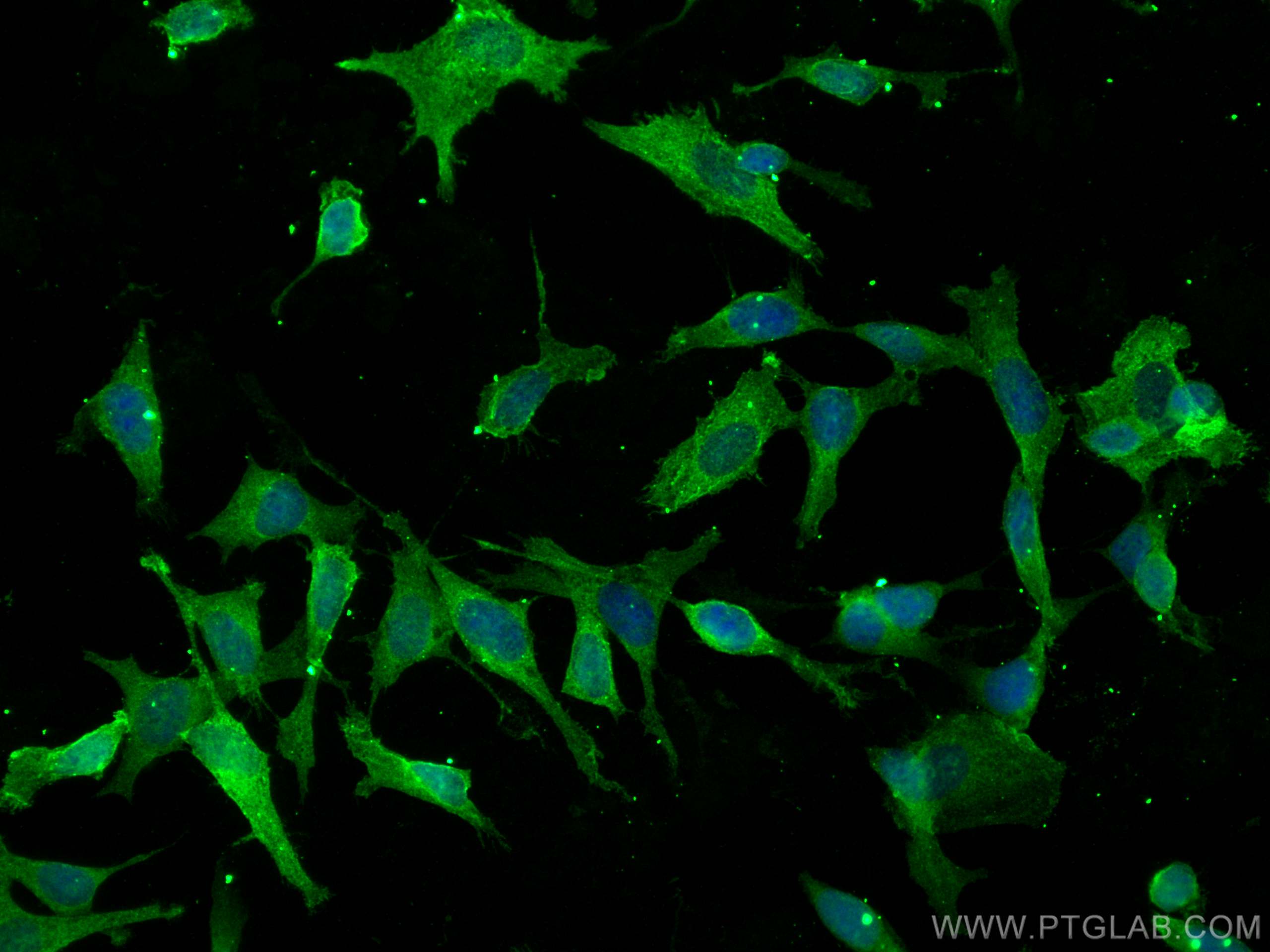 IF Staining of SH-SY5Y using 68247-1-Ig