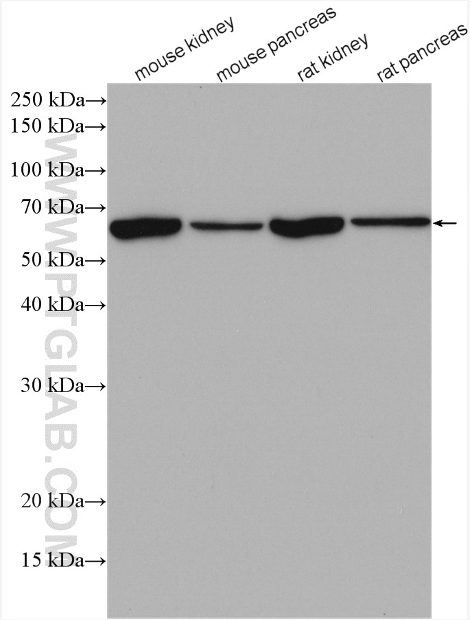 Western Blot (WB) analysis of various lysates using KLKB1 Polyclonal antibody (27991-1-AP)