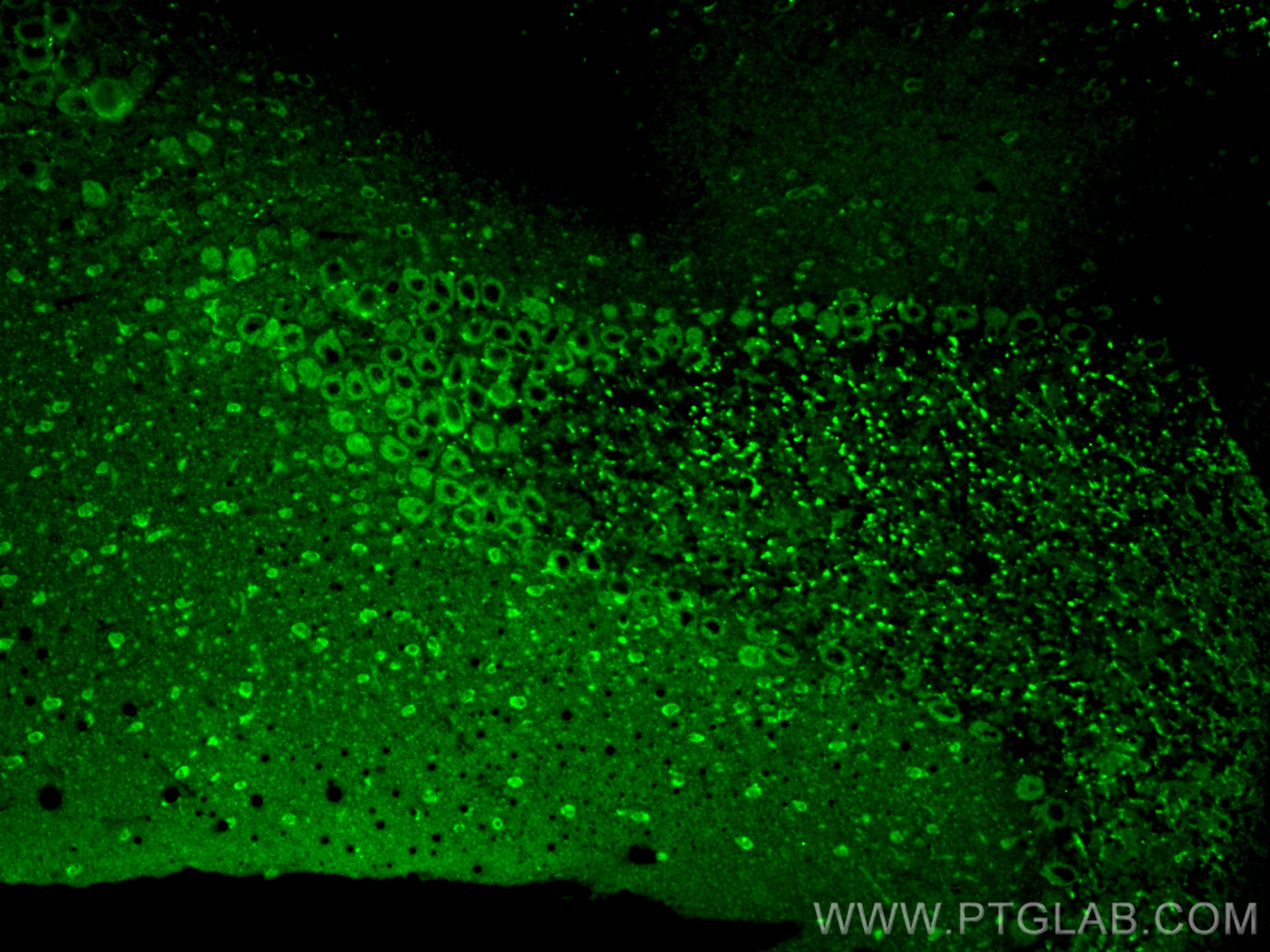 Immunofluorescence (IF) / fluorescent staining of mouse cerebellum tissue using PPP1R21 Polyclonal antibody (31532-1-AP)