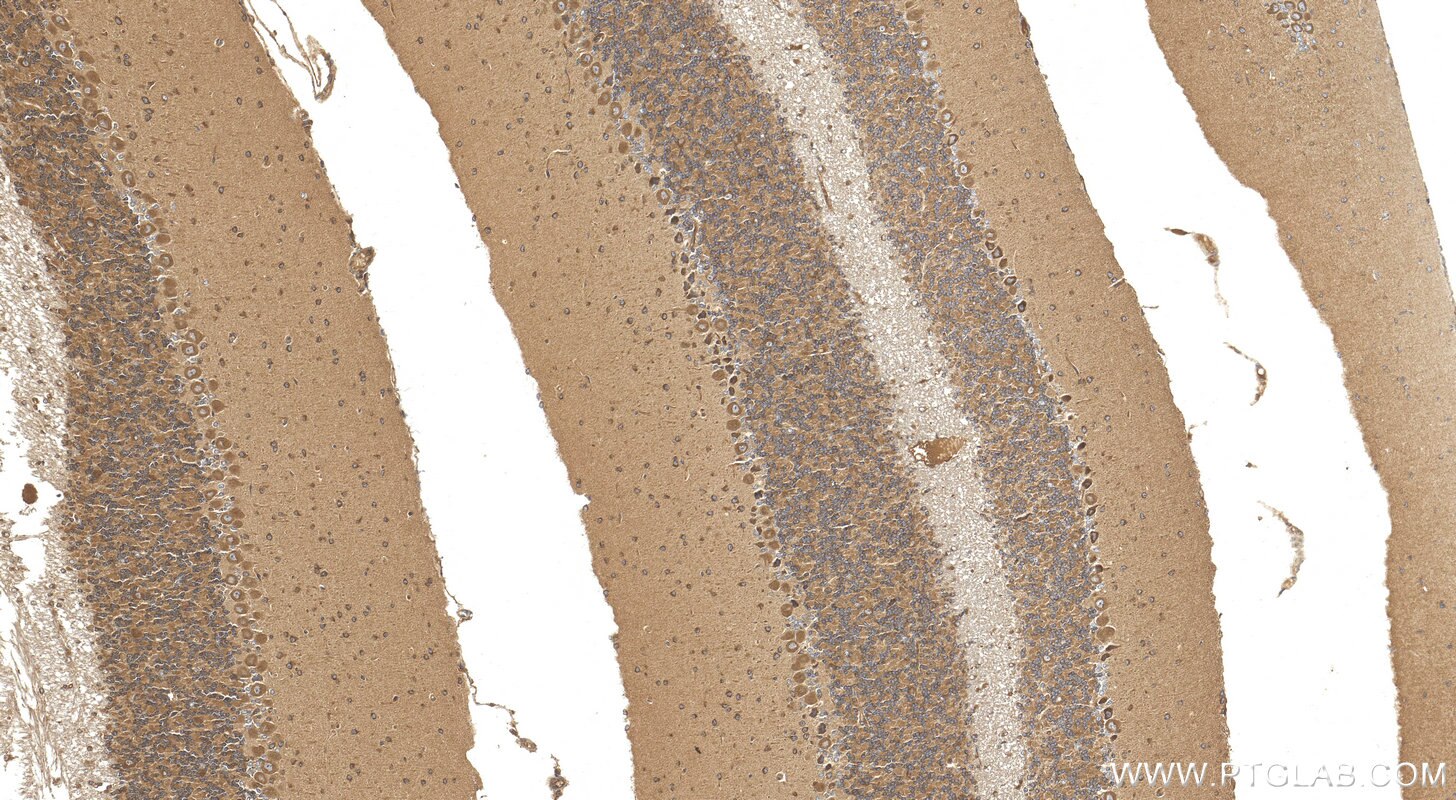 Immunohistochemistry (IHC) staining of mouse cerebellum tissue using PPP1R21 Polyclonal antibody (31532-1-AP)