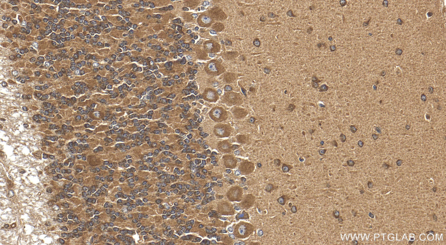 Immunohistochemistry (IHC) staining of mouse cerebellum tissue using PPP1R21 Polyclonal antibody (31532-1-AP)