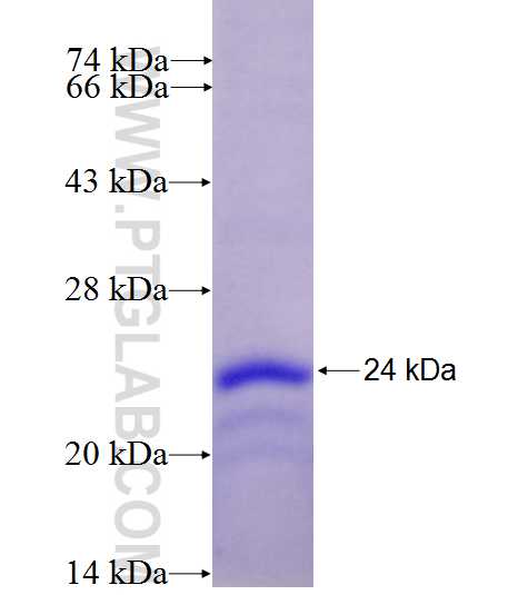 KLRB1,CD161 fusion protein Ag27117 SDS-PAGE