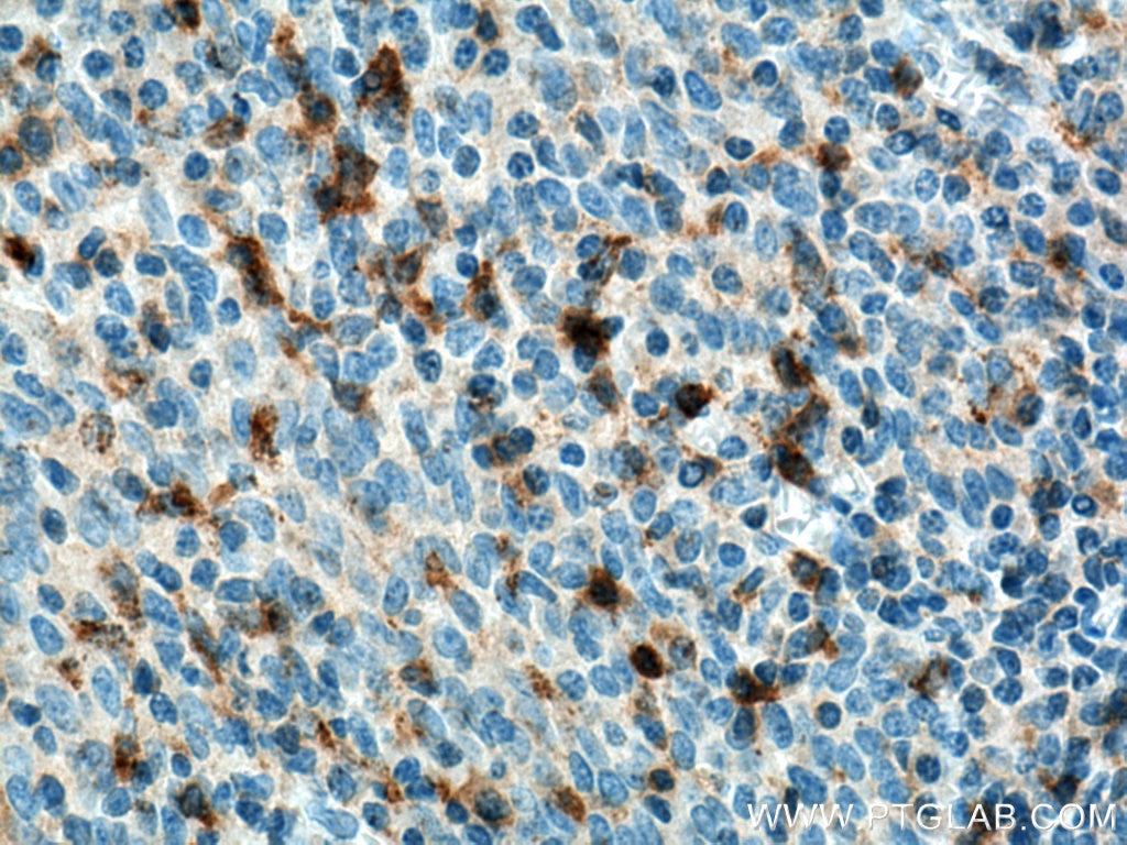 Immunohistochemistry (IHC) staining of human tonsillitis tissue using KLRB1/CD161 Monoclonal antibody (67537-1-Ig)