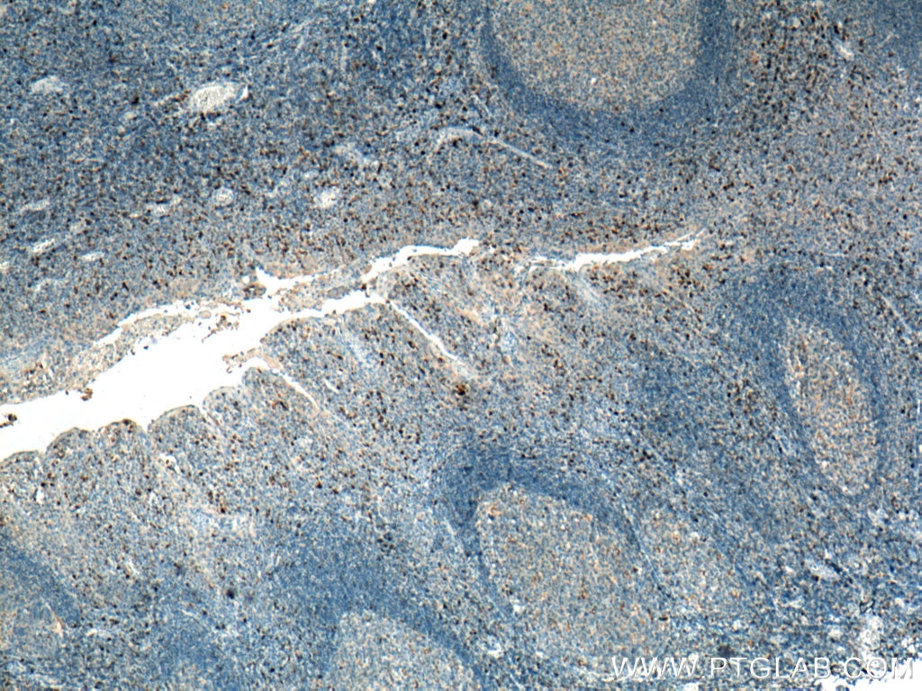 Immunohistochemistry (IHC) staining of human tonsillitis tissue using KLRB1/CD161 Monoclonal antibody (67537-1-Ig)