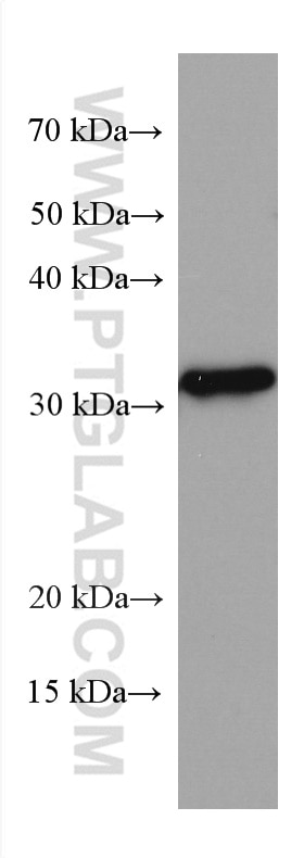 Western Blot (WB) analysis of human spleen tissue using KLRB1/CD161 Monoclonal antibody (67537-1-Ig)