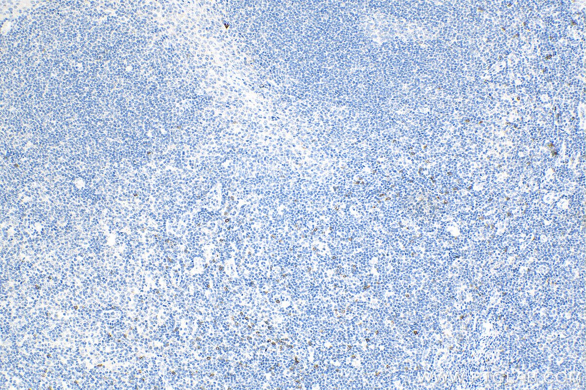 Immunohistochemistry (IHC) staining of human tonsillitis tissue using NKG2A Polyclonal antibody (10935-1-AP)