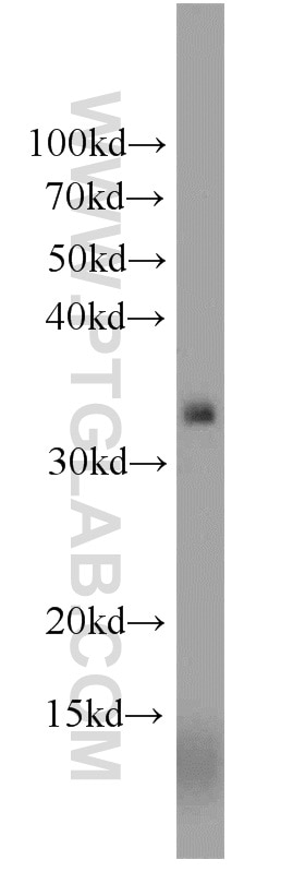 Western Blot (WB) analysis of human liver tissue using NKG2A Polyclonal antibody (10935-1-AP)