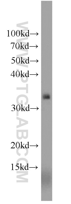 WB analysis of human liver using 10935-1-AP