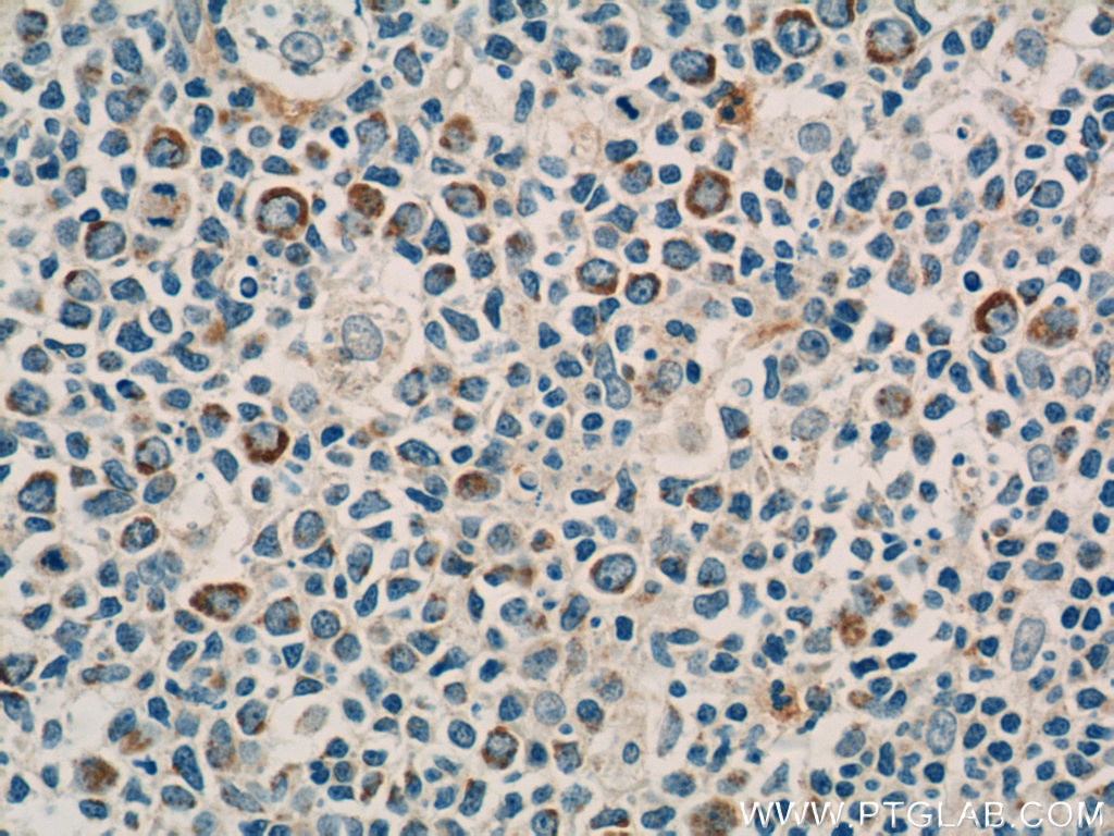 CD94 Polyclonal antibody