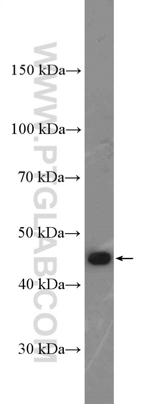 Western Blot (WB) analysis of K-562 cells using CD94 Polyclonal antibody (13332-1-AP)