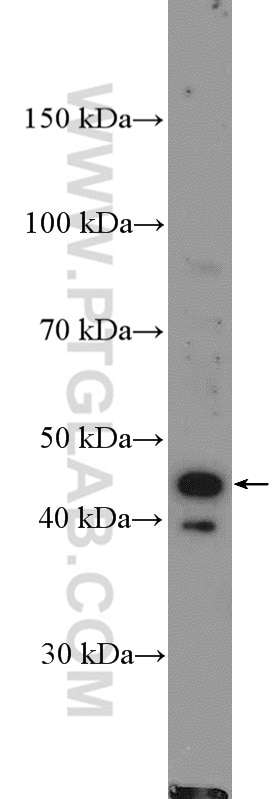 Western Blot (WB) analysis of Jurkat cells using CD94 Polyclonal antibody (13332-1-AP)