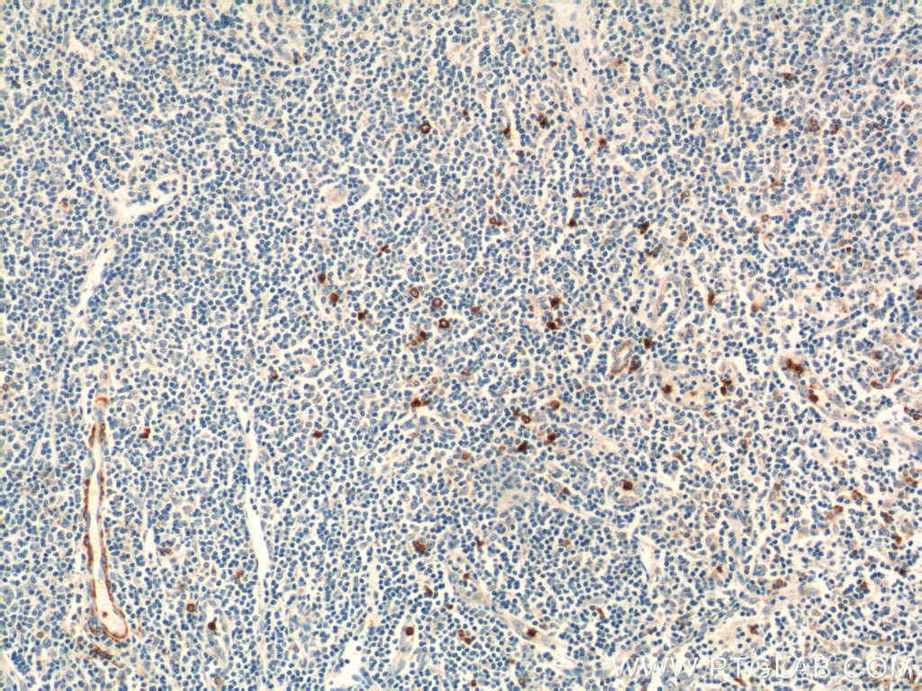 Immunohistochemistry (IHC) staining of human tonsillitis tissue using KLRF1 Polyclonal antibody (21510-1-AP)