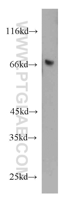 WB analysis of human spleen using 21510-1-AP