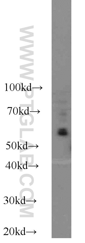 Western Blot (WB) analysis of Raji cells using KLRG1 Polyclonal antibody (10974-1-AP)