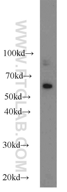Western Blot (WB) analysis of human peripheral blood leukocyte using KLRG1 Polyclonal antibody (10974-1-AP)