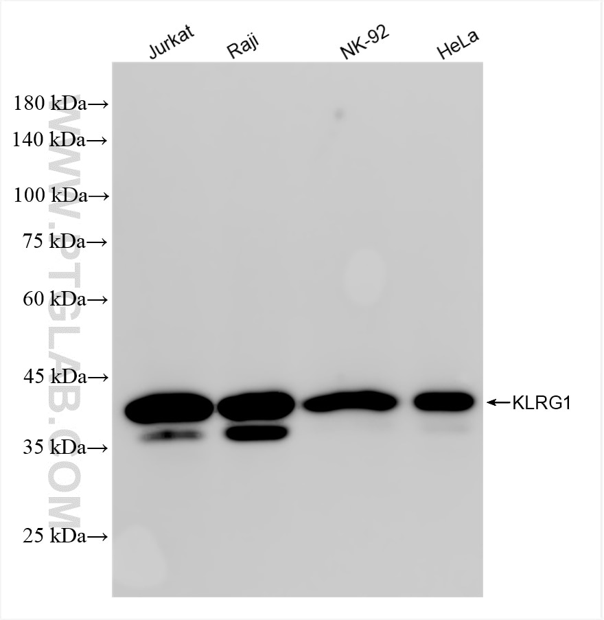 Western Blot (WB) analysis of various lysates using KLRG1 Recombinant antibody (84785-4-RR)