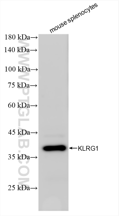 Western Blot (WB) analysis of various lysates using KLRG1 Recombinant antibody (84785-4-RR)
