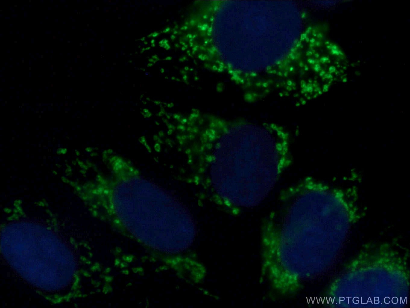 Immunofluorescence (IF) / fluorescent staining of MCF-7 cells using KMO Polyclonal antibody (10698-1-AP)