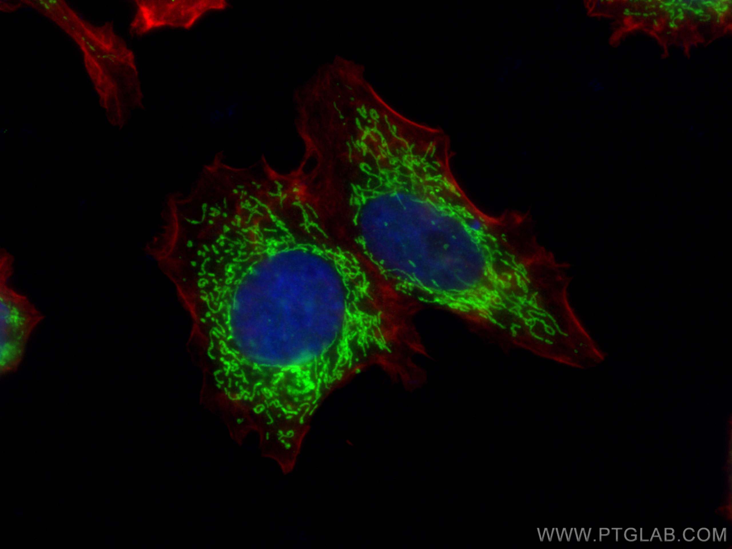 Immunofluorescence (IF) / fluorescent staining of MCF-7 cells using KMO Polyclonal antibody (10698-1-AP)