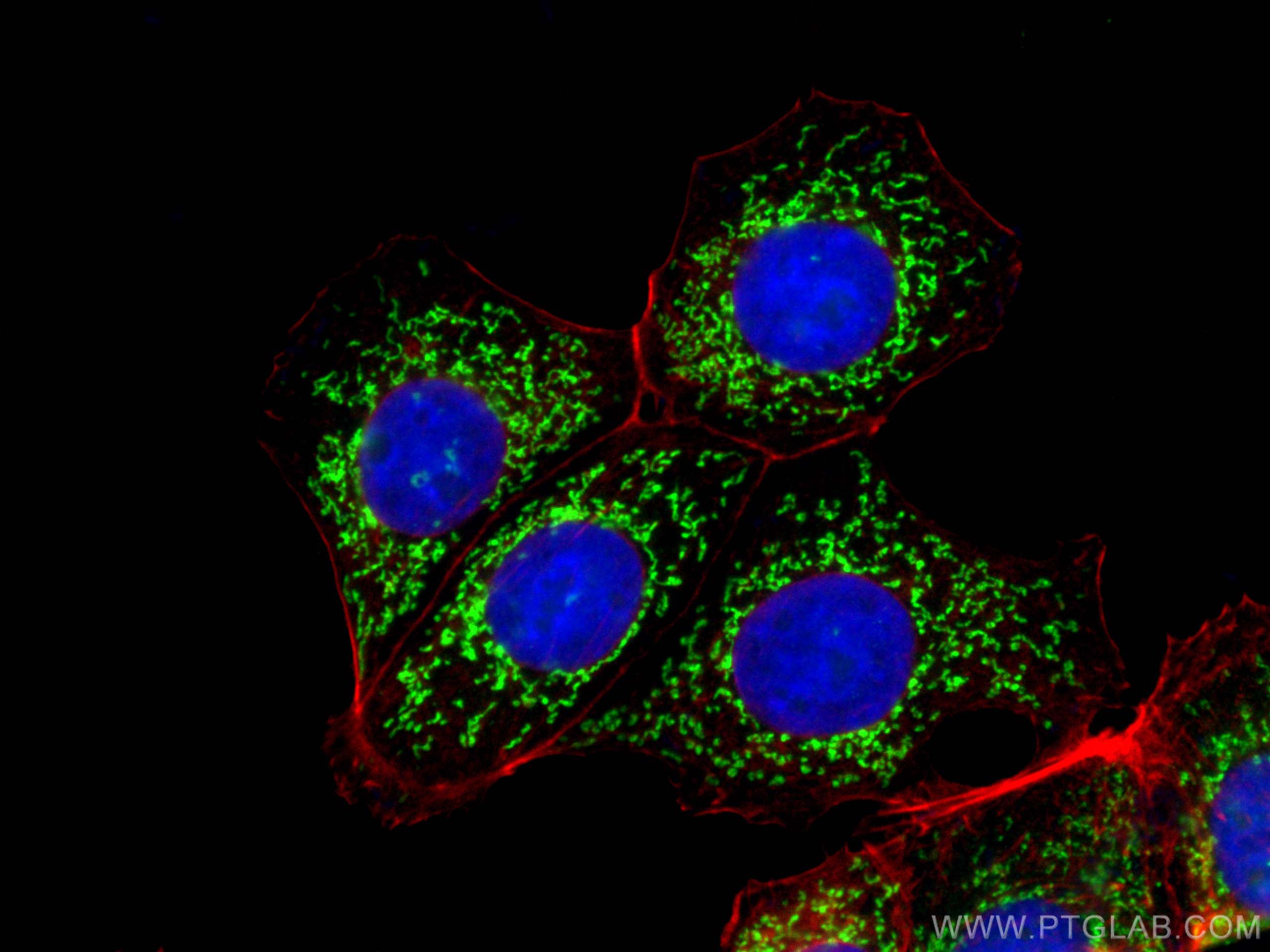 Immunofluorescence (IF) / fluorescent staining of MCF-7 cells using KMO Polyclonal antibody (10698-1-AP)