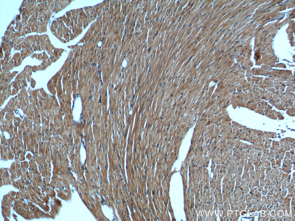 Immunohistochemistry (IHC) staining of mouse heart tissue using KMO Polyclonal antibody (10698-1-AP)