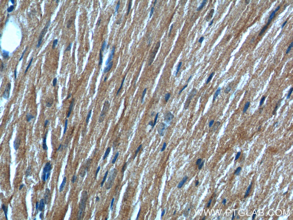 Immunohistochemistry (IHC) staining of mouse heart tissue using KMO Polyclonal antibody (10698-1-AP)