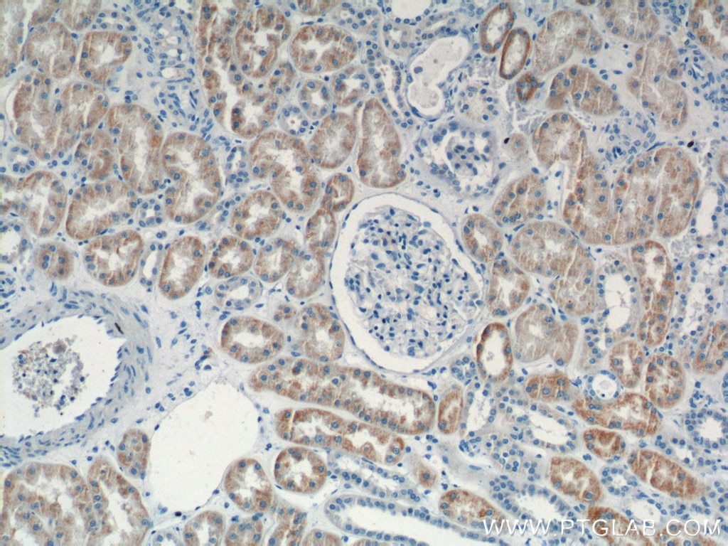 Immunohistochemistry (IHC) staining of human kidney tissue using KMO Polyclonal antibody (10698-1-AP)