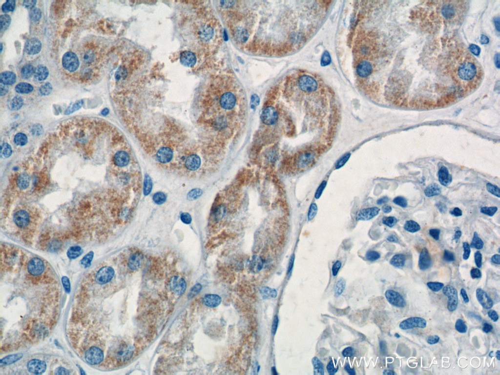 Immunohistochemistry (IHC) staining of human kidney tissue using KMO Polyclonal antibody (10698-1-AP)