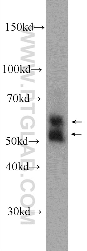 Western Blot (WB) analysis of rat spleen tissue using KMO Polyclonal antibody (10698-1-AP)