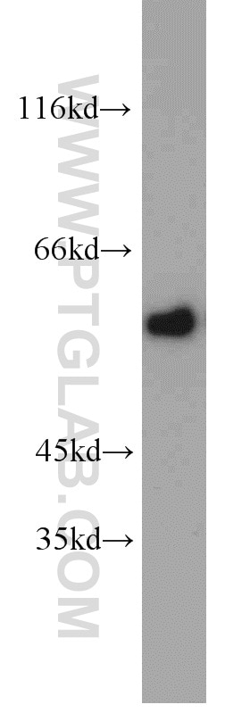 Western Blot (WB) analysis of mouse spleen tissue using KMO Polyclonal antibody (10698-1-AP)