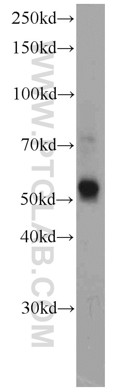 Western Blot (WB) analysis of HeLa cells using KMO Polyclonal antibody (10698-1-AP)