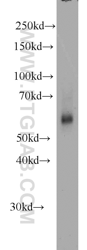 Western Blot (WB) analysis of mouse heart tissue using KMO Polyclonal antibody (10698-1-AP)