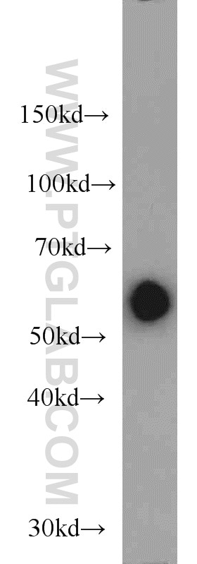 WB analysis of mouse spleen using 10698-1-AP