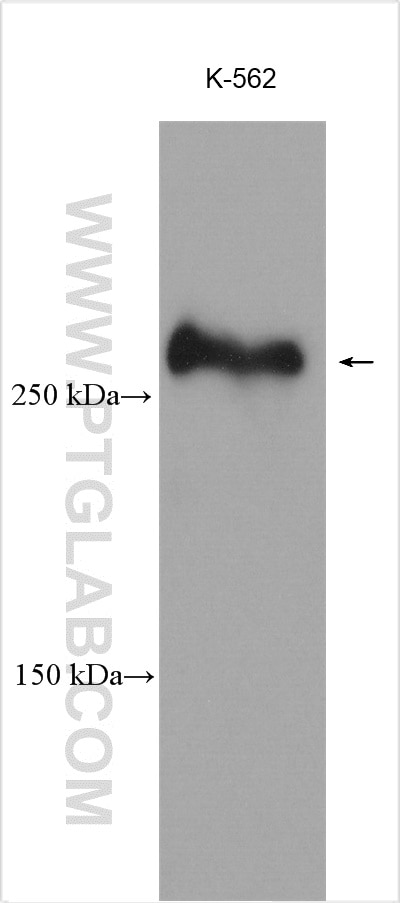 Western Blot (WB) analysis of various lysates using KMT2C Polyclonal antibody (28437-1-AP)