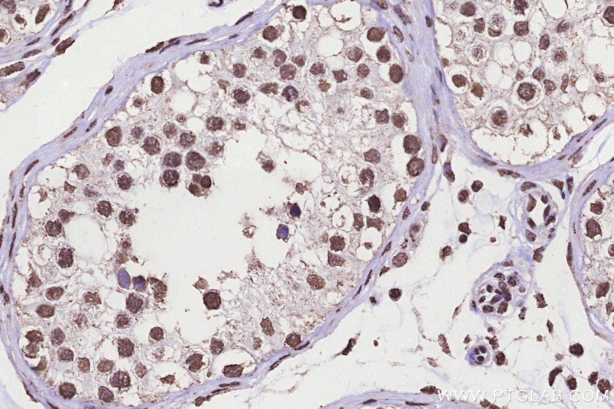 IHC staining of human testis using 83595-4-RR Immunohistochemistry (IHC) staining of human testis tissue using KMT2C Recombinant monoclonal antibody (83595-4-RR)