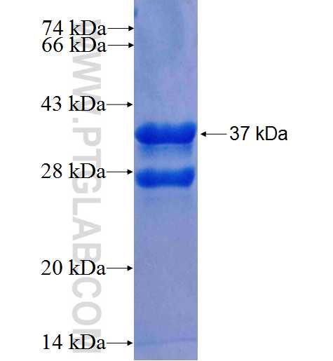 KMT2D fusion protein Ag26195 SDS-PAGE