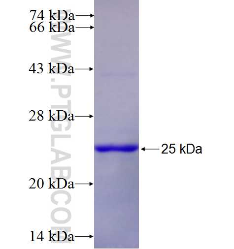 KMT2D fusion protein Ag27163 SDS-PAGE