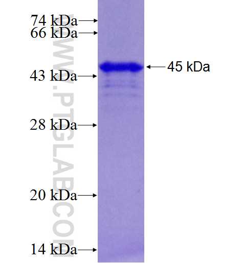 KMT2D fusion protein Ag27227 SDS-PAGE