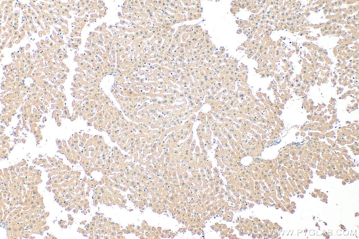 Immunohistochemistry (IHC) staining of mouse liver tissue using KNCN Polyclonal antibody (21532-1-AP)