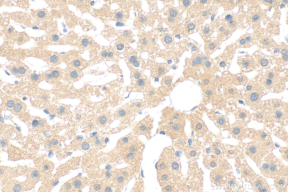 Immunohistochemistry (IHC) staining of mouse liver tissue using KNCN Polyclonal antibody (21532-1-AP)