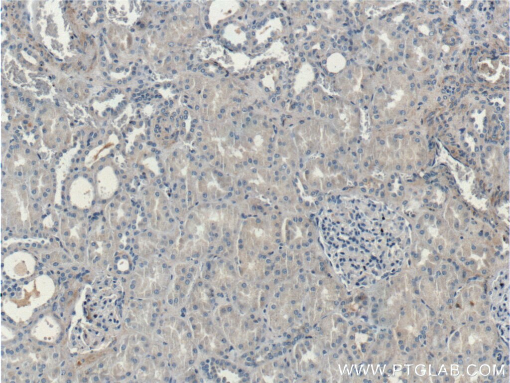Immunohistochemistry (IHC) staining of human kidney tissue using Kininogen 1 Polyclonal antibody (11926-1-AP)