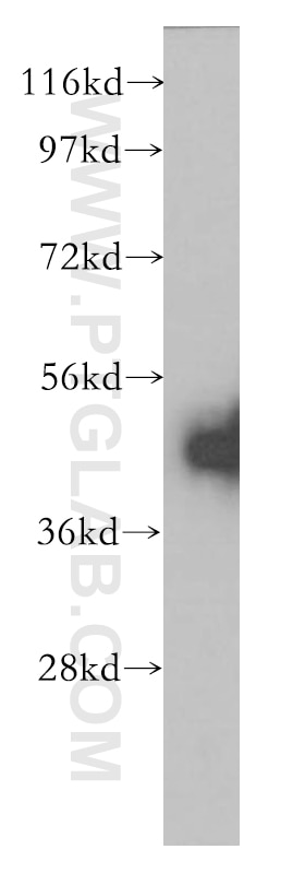 WB analysis of HeLa using 11926-1-AP