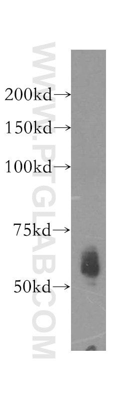 Western Blot (WB) analysis of A2780 cells using Kininogen 1 Polyclonal antibody (11926-1-AP)