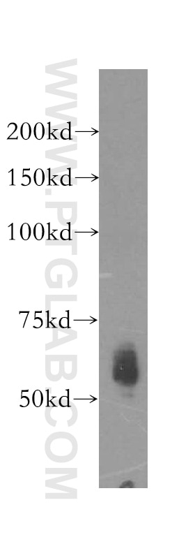 WB analysis of A2780 using 11926-1-AP