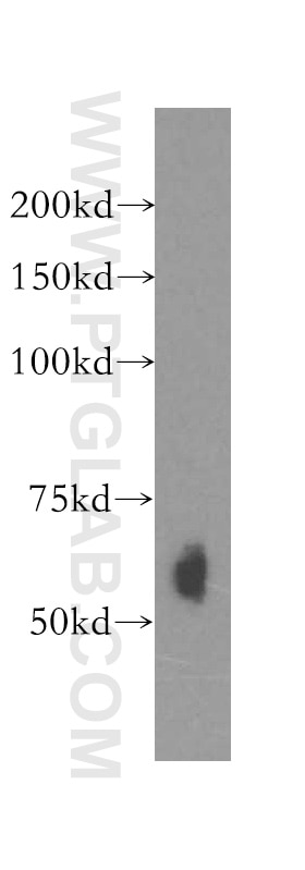 Western Blot (WB) analysis of COLO 320 cells using Kininogen 1 Polyclonal antibody (11926-1-AP)