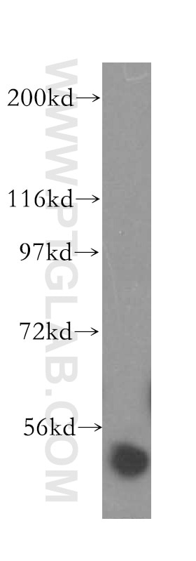 Western Blot (WB) analysis of HeLa cells using Kininogen 1 Polyclonal antibody (11926-1-AP)