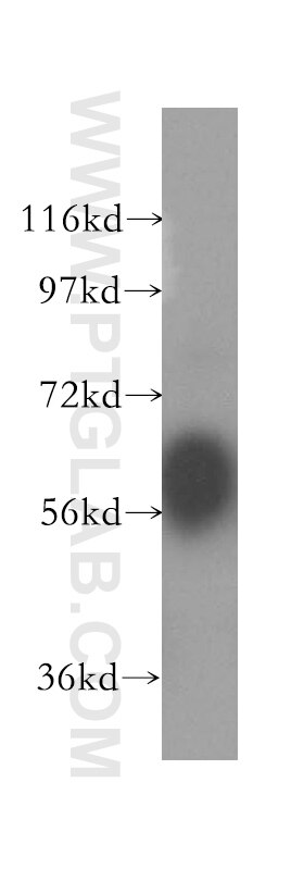 Western Blot (WB) analysis of HeLa cells using Kininogen 1 Polyclonal antibody (11926-1-AP)