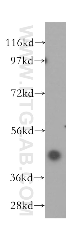 Western Blot (WB) analysis of MCF-7 cells using Kininogen 1 Polyclonal antibody (11926-1-AP)