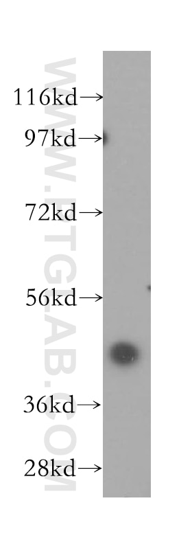 WB analysis of MCF-7 using 11926-1-AP