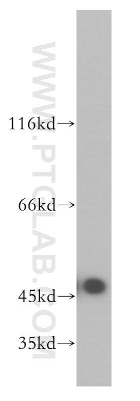 Western Blot (WB) analysis of HeLa cells using Kininogen 1 Polyclonal antibody (11926-1-AP)